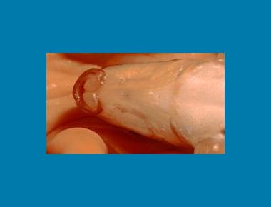Close up of mouthparts (from Little Campbell River) A Rocha